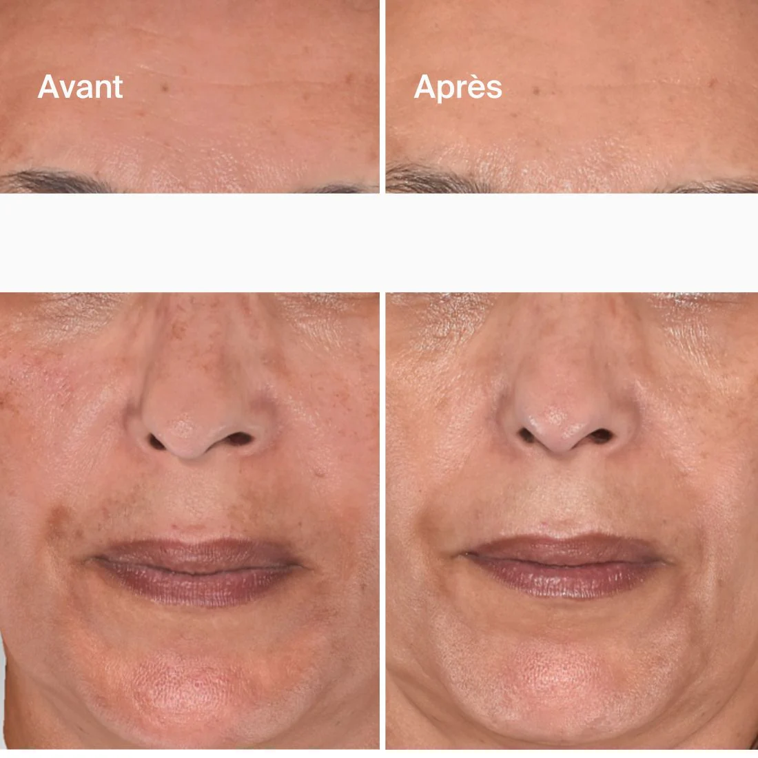 Éclat - Acide Hyaluronique + Safran - Image 3
